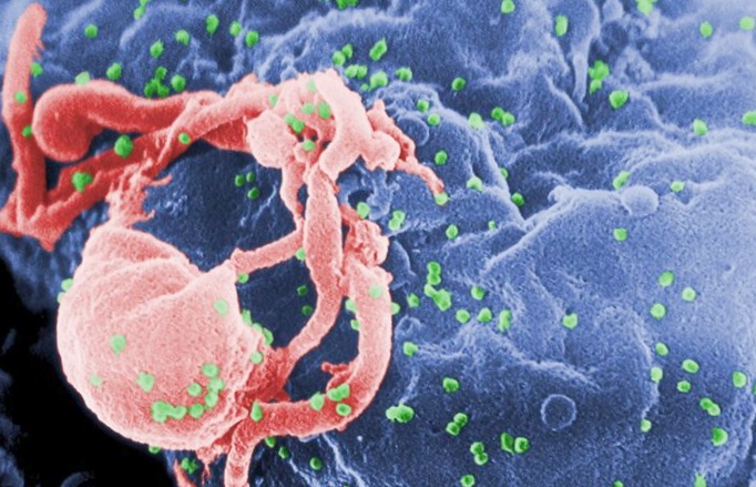 Ученые определили, как вирус спида распространяется по организму